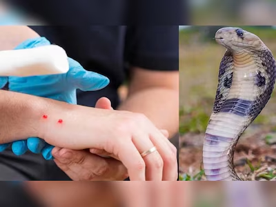 ರಾಜ್ಯದಲ್ಲಿ ಹಾವು ಕಡಿತ ಪ್ರಕರಣ ರೆಕಾರ್ಡ್: 10 ತಿಂಗಳಲ್ಲಿ 18,000 ಕೇಸ್, 125 ಜನ ಸಾ*. |