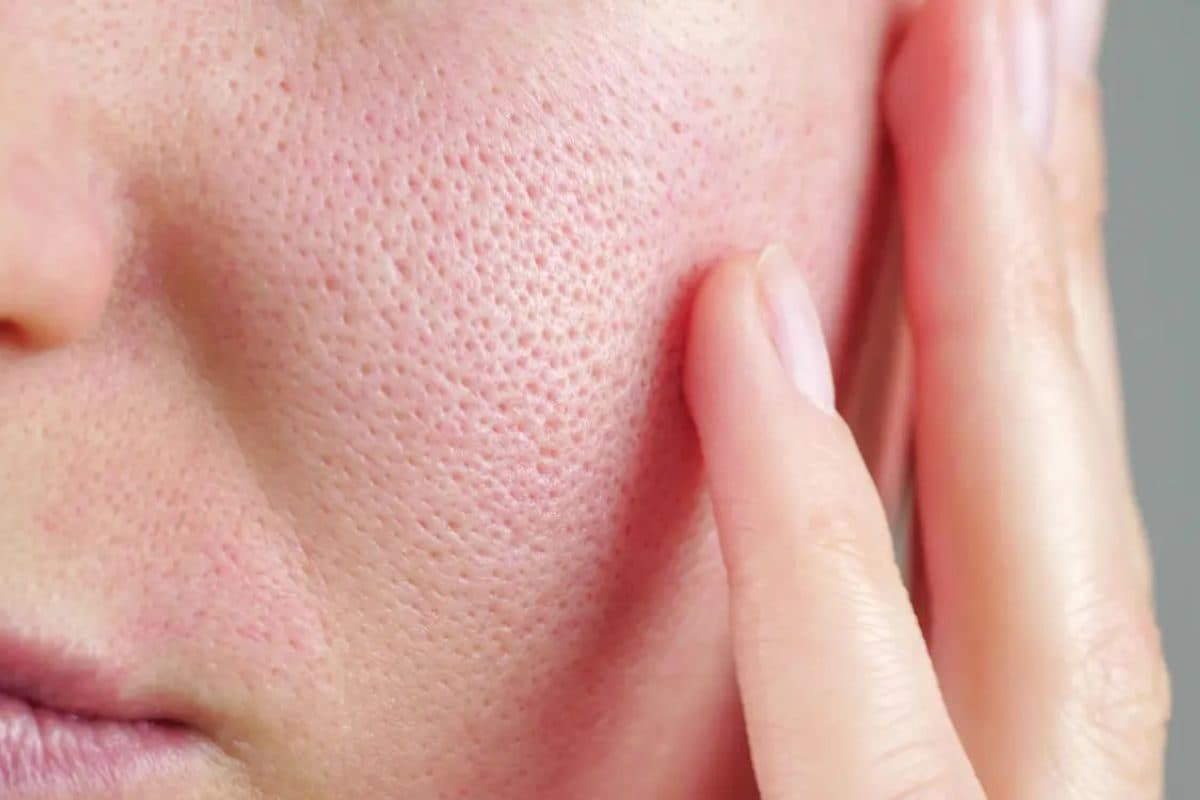 ಚಳಿಗಾಲದಲ್ಲಿ ಒಣ ಚರ್ಮ? ಈ ನೈಸರ್ಗಿಕ ಟಿಪ್ಸ್ ನಿಮ್ಮ ರಕ್ಷಕ!