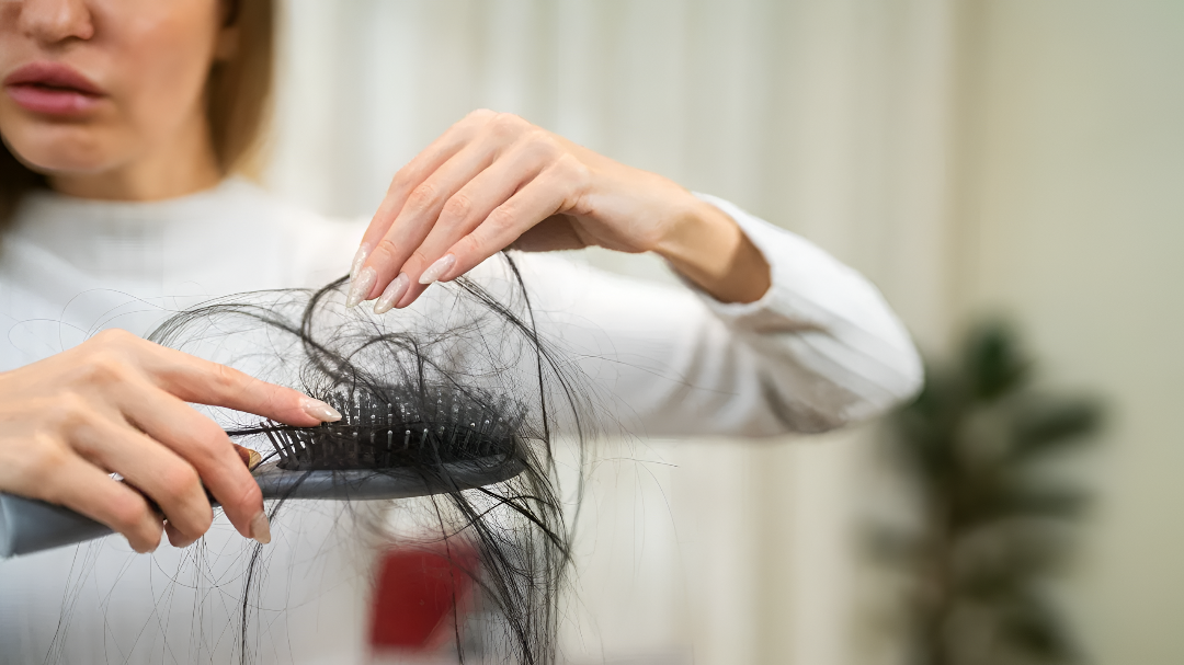 ಕೂದಲು ಉದುರೋ ಸಮಸ್ಯೆ ಕಾಡ್ತಿದೆಯಾ?