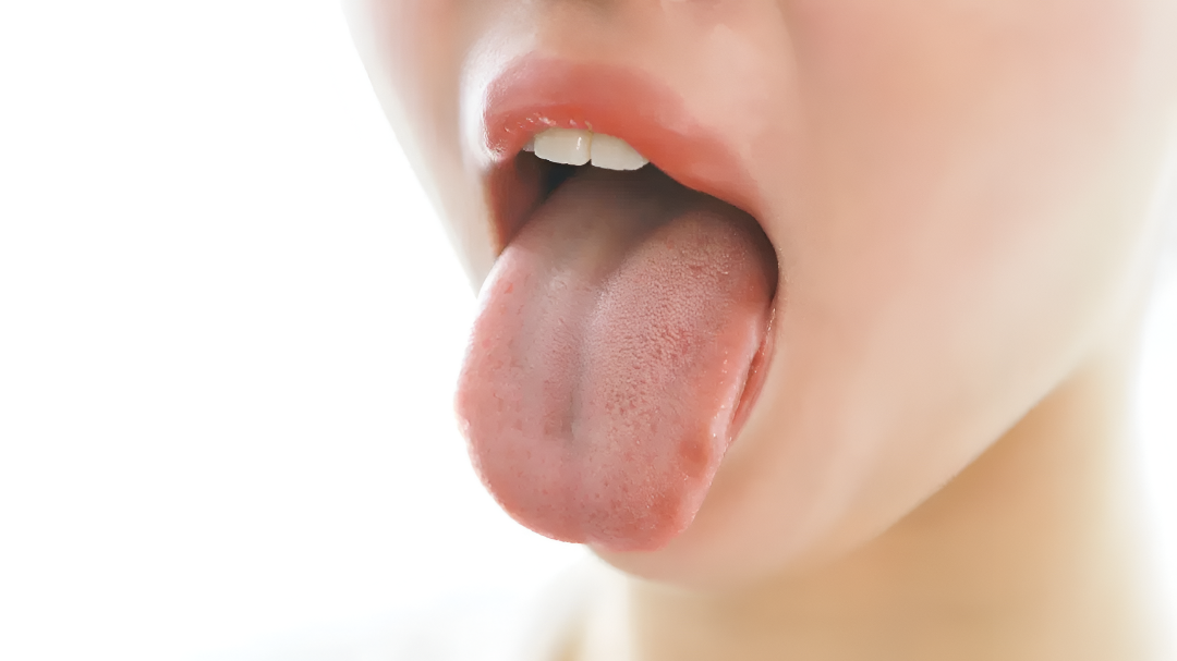 ಡಾಕ್ಟರ್ ಯಾಕೆ “ನಾಲಿಗೆ ತೋರಿಸಿ” ಎನ್ನುತ್ತಾರೆ?