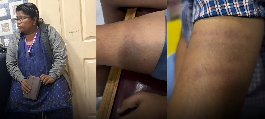 ಹೋಂವರ್ಕ್ ಮಾಡಿಲ್ಲವೆಂದು 4ನೇ ತರಗತಿ ಬಾಲಕನ ಮೇಲೆ ಶಿಕ್ಷಕಿ ಹ*.