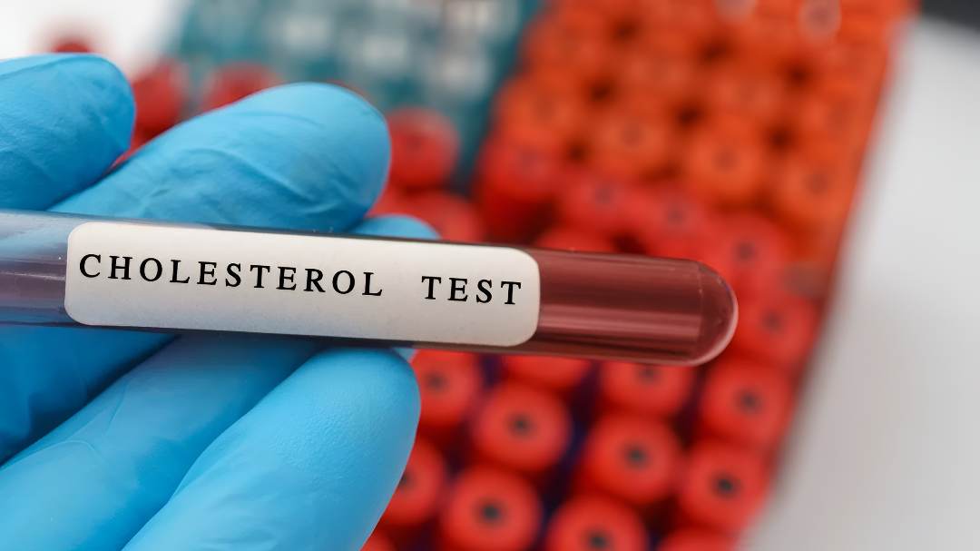 ಚರ್ಮವೇ ಹೇಳುತ್ತದೆ ಕೊಲೆಸ್ಟ್ರಾಲ್ ಕಥೆ!