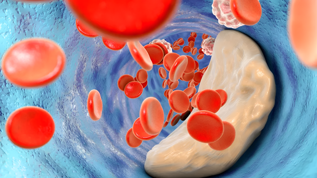 ಚಳಿಗಾಲದಲ್ಲಿ ಈ ಆಹಾರಗಳು ಸೇವನೆಯಿಂದ ಕೆಟ್ಟ ಕೊಲೆಸ್ಟ್ರಾಲ್ ಹೆಚ್ಚಬಹುದು!