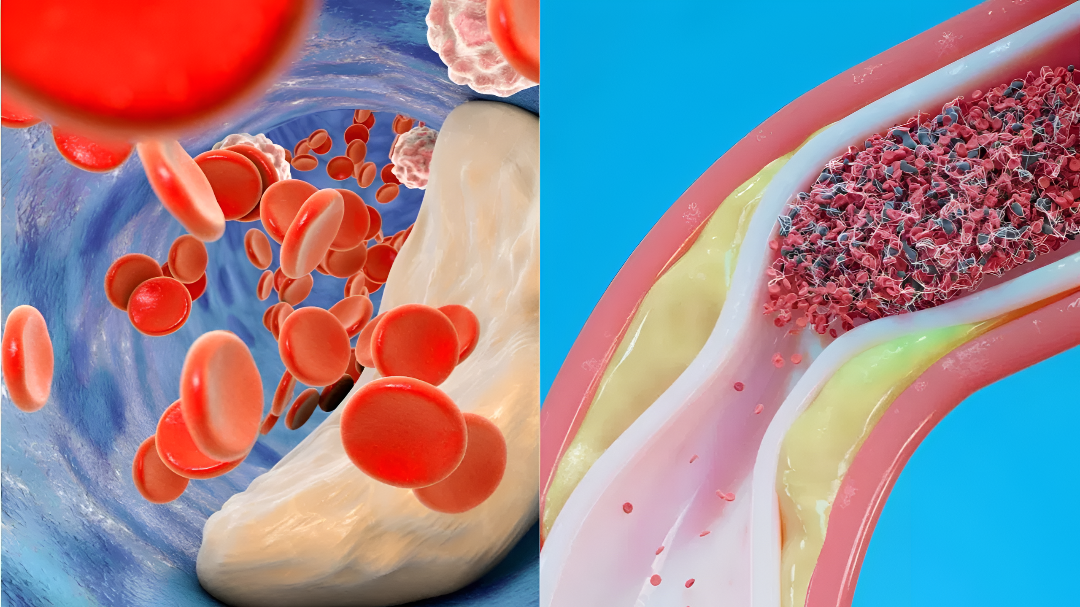 ಕೊಲೆಸ್ಟ್ರಾಲ್ ಹೆಚ್ಚಳವೇ? ದಿನವೂ ಈ ನಿಯಮ ಪಾಲಿಸಿ.