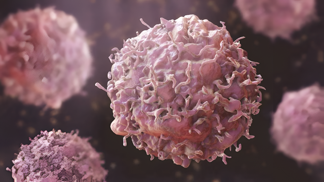 ಕ್ಯಾನ್ಸರ್ ಚಿಕಿತ್ಸೆಯಲ್ಲಿ ಆಯುರ್ವೇದದ ಪಾತ್ರ? ಬಾಬಾ ರಾಮದೇವ್ ಅಭಿಪ್ರಾಯ.