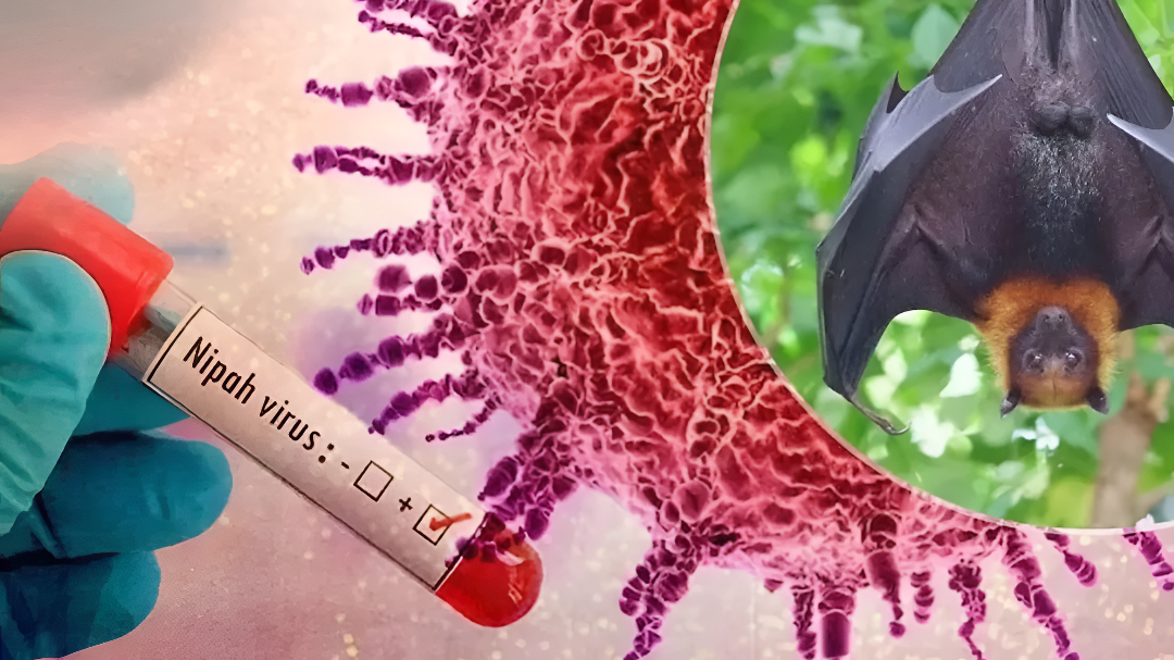 ಮತ್ತೆ ನಿಫಾ ಆತಂಕ: ಕರ್ನಾಟಕದಲ್ಲಿ ಹೈ ಅಲರ್ಟ್.