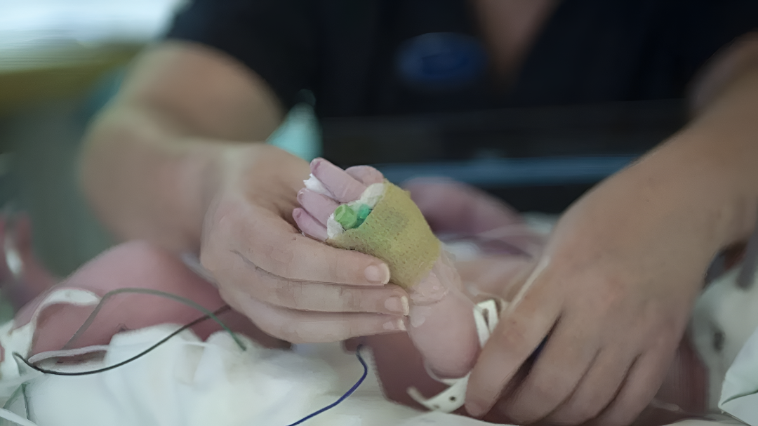 ನರ್ಸ್ ನಿರ್ಲಕ್ಷ್ಯ: 6 ತಿಂಗಳ ಮಗುವಿನ ಬೆರಳೇ ಕತ್ತರಿಸಿದ ಘಟನೆ