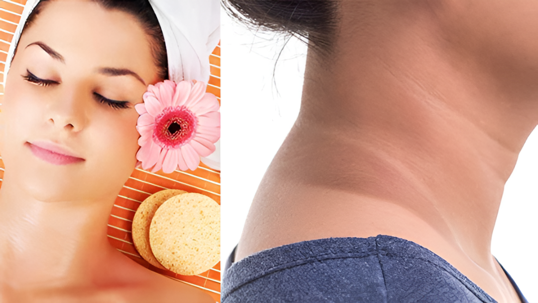 ಕುತ್ತಿಗೆ, ಗಲ್ಲದಲ್ಲಿ ಕಪ್ಪಾಗುವುದು: ಕಾರಣ ಮತ್ತು ಎಚ್ಚರಿಕೆ.!